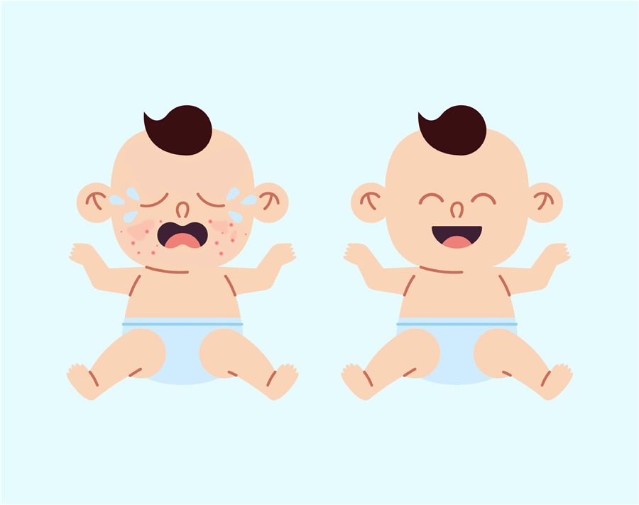 Bé quấy khóc vì da mẩn đỏ và bé cười khi da dịu lại