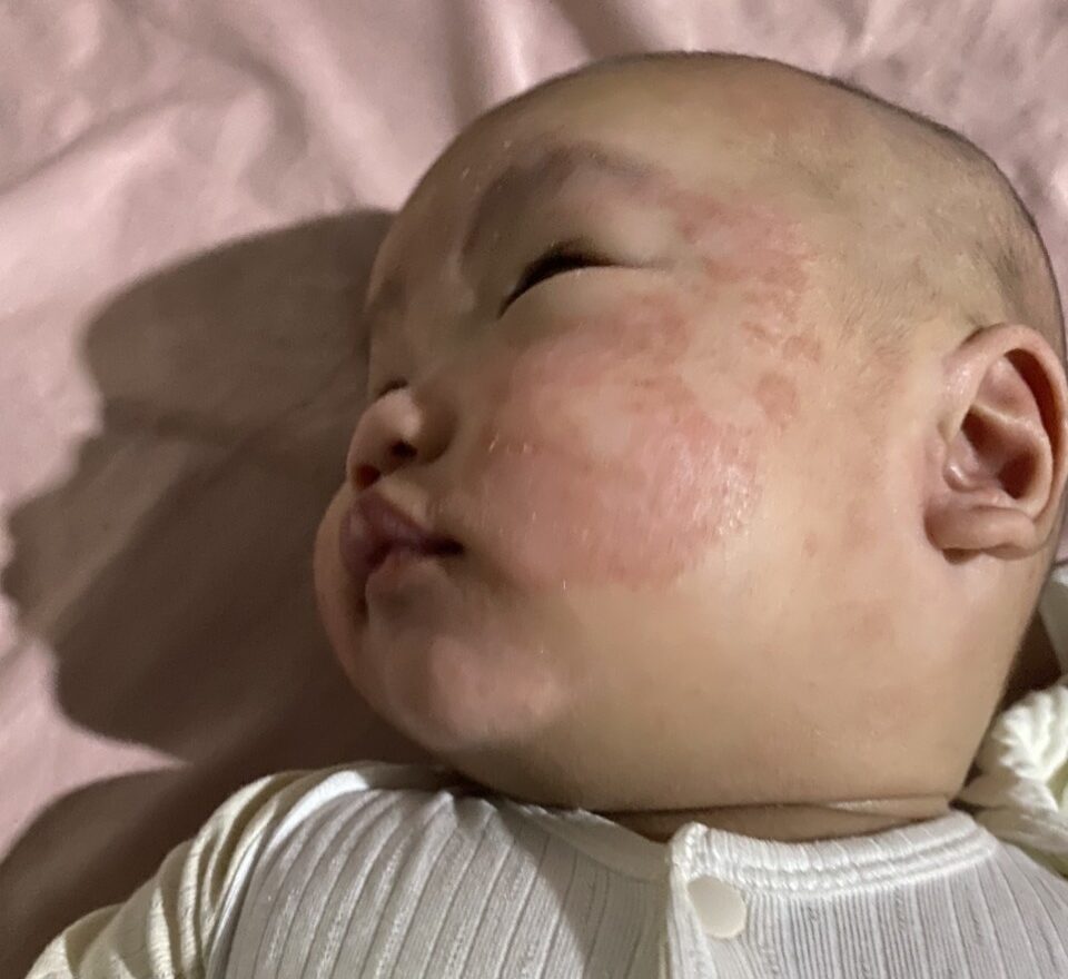 Ảnh Before - After thực tế