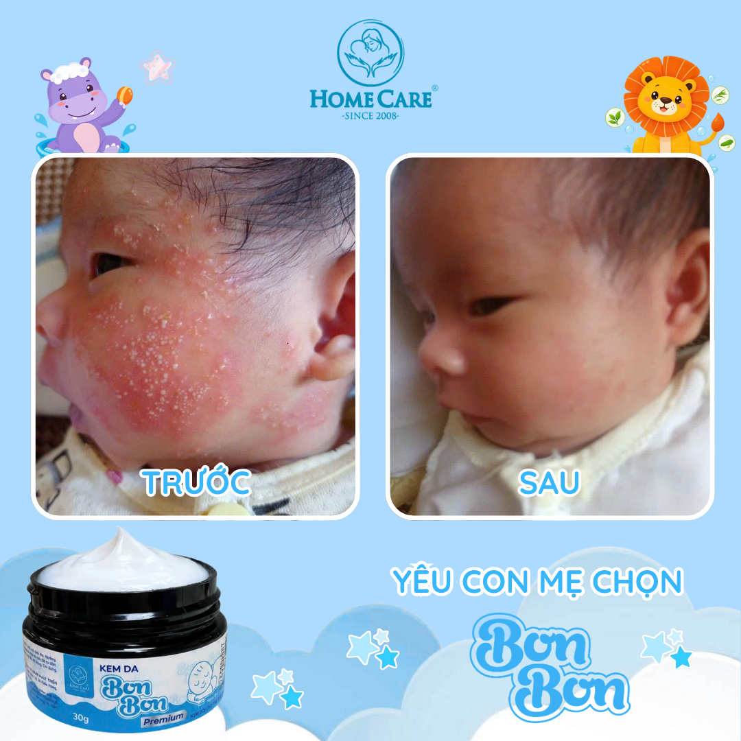 Ảnh Before - After thực tế