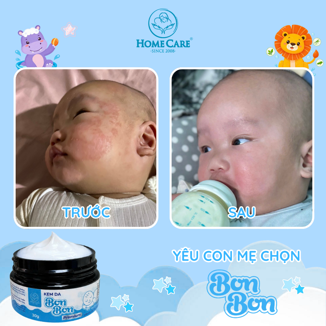 Ảnh Before - After thực tế