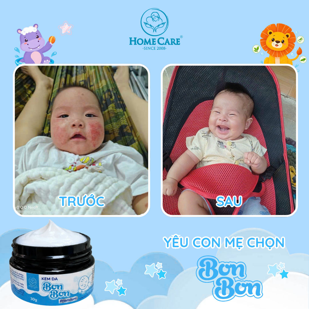 Ảnh Before - After thực tế