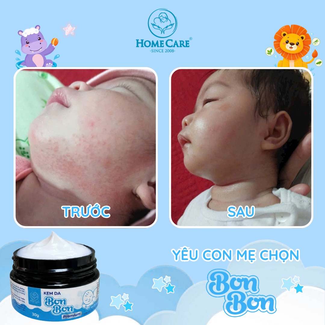 Ảnh Before - After thực tế